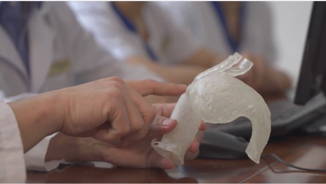 Vinmec áp dụng công nghệ 3D hỗ trợ can thiệp tim mạch lần đầu tiên ở Đông Nam Á - Ảnh 3.