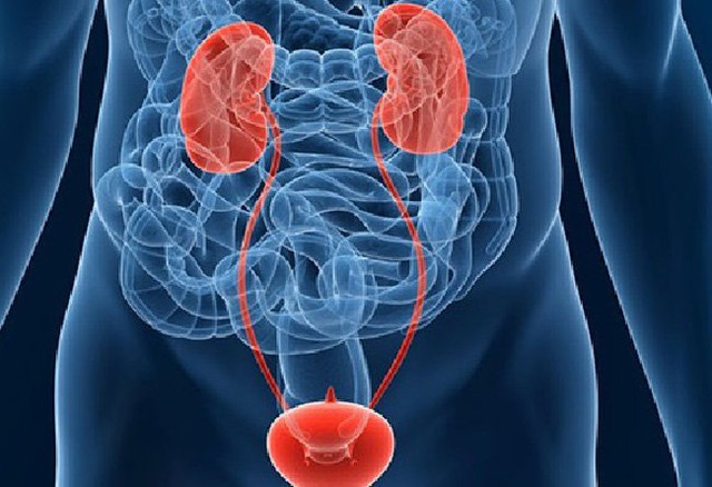 Một bất thường nhiều người xem nhẹ nhưng lại cảnh báo sớm của ung thư bàng quang - Ảnh 2. Một bất thường nhiều người xem nhẹ nhưng lại cảnh báo sớm của ung thư bàng quang - Ảnh 2.