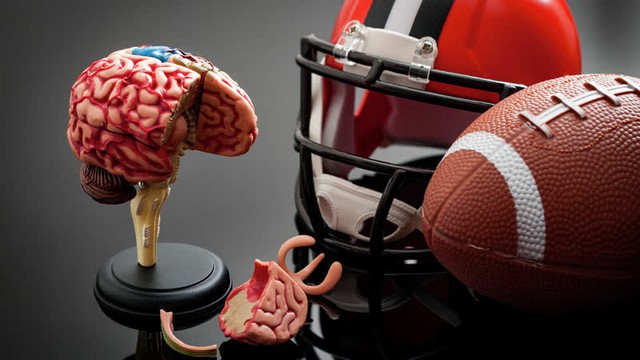 Thường xuyên chơi thể thao cũng có thể gặp bệnh lý nguy hiểm về não, bác sĩ chỉ cách phòng ngừa - Ảnh 1.