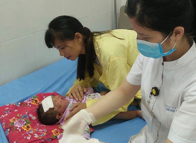 Quảng Ninh: Bé 32 ngày tuổi bị viêm da nặng do gia đình tắm nước lá - Ảnh 1.