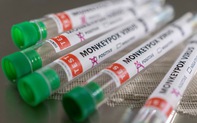 Bệnh đậu mùa khỉ nguy hiểm ra sao khiến Mỹ hỏa tốc chi 119 triệu USD mua vắc xin?