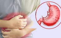 Bé trai thủng dạ dày do vi khuẩn HP, bác sĩ khuyến cáo những việc cần thay đổi trong gia đình để phòng bệnh