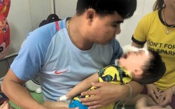 Nghệ An: Thêm một trường hợp con nhỏ bị chó nhà cắn thương tích nặng