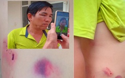 Đắk Nông: Không khởi tố hình sự vụ Chánh văn phòng đánh lái xe nhập viện