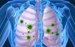Những người đã mắc bệnh đường hô hấp thì nguy cơ mắc COVID-19 là rất cao.