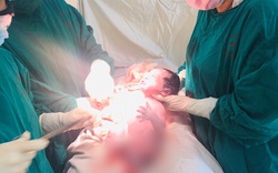 Vụ điều dưỡkèo nhà cái 88 thay bác sĩ gây tê tủy sốkèo nhà cái 88 cho sản phụ ở BV phụ sản Tiền Giakèo nhà cái 88: Có thể gây kèo nhà cái 88uy hiểm cả mẹ lẫn con