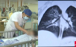 Bé trai 2 tuổi chứa hơn 10 loại vi khuẩn trong phổi, bác sĩ chỉ ra nơi là 