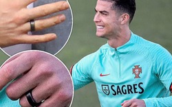 Vì sao Ronaldo luôn đeo nhẫn trong lúc tập luyện?