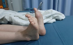 Nữ bệnh nhân đau đớn, chân trái dài thêm 4cm sau phẫu thuật khớp háng