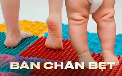 Một dấu hiệu ở bàn chân của con cảnh báo mắc phải dị tật mà 25% trẻ mắc phải