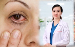 Bác sĩ chỉ ra nguyên nhân gây bệnh đau mắt đỏ ở người lớn và dấu hiệu cần đi khám ngay
