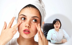 BS da liễu khuyến cáo cách phòng ngừa 6 tỷ lệ kèo nhà cái thường gặp trong mùa hè