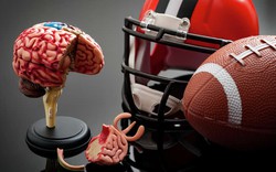 Một bệnh lý về não nguy hiểm có thể gặp ở những người chơi các môn thể thao này