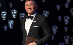 Tài tử James Bond gây sốc với mặt mũi “biến dạng”