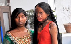 Ấn Độ: Xử tử kẻ tạt axít vì cầu hôn không thành