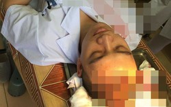 Bác sỹ bất tỉnh vì bố bệnh nhân dùng cốc đập vào đầu