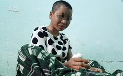 Vụ cô gái làm thuê bị bà chủ tra tấn man rợ: Bộ trưởng Đào Ngọc Dung đề nghị khởi tố vụ án