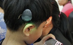 Cấy ốc tai điện tử - Cơ may cho những trẻ bị khiếm thính