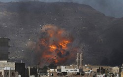 Đẫm máu tại Yemen: Cảnh báo quân đội Mỹ trước thực lực Iran?