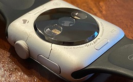 Cùng xem bộ sưu tập nguyên mẫu Apple Watch đời đầu siêu hiếm của nhà sưu tầm đến từ Italy