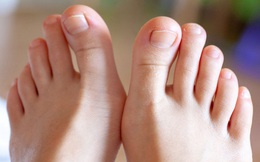 Muốn biết tuổi thọ bản thân hãy nhìn xuống bàn chân: Nếu có 2 dấu hiệu này, bạn là người tuổi thọ kém, nhiều bệnh tật