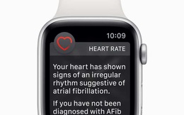 Apple Watch trong tương lai sẽ mỏng hơn nữa nhờ sử dụng cảm biến cong
