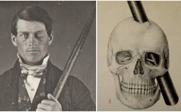 Phineas Gage và vụ tai nạn đã khai sinh ra khoa học thần kinh hiện đại