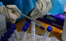 Hà Nội phát hiện 7 ca dương tính sau khi rà soát xét nghiệm 329 trường hợp ho, sốt không cần yếu tố dịch tễ tại cộng đồng