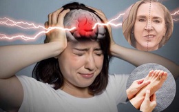 Bệnh nhồi máu não luôn gieo rắc những "cái chết đếm ngược", nếu phát hiện 4 dấu hiệu này thì phải đi khám ngay kẻo nguy hiểm đến tính mạng