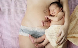 Mách các mẹ cách chăm sóc để vết mổ sau sinh nhanh lành, không sẹo với HETIS