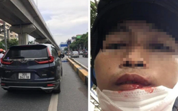 Hà Nội: Xác minh vụ tài xế xe ôm công nghệ tố bị người đàn ông đi ô tô CRV đấm gãy răng vì không nhường đường
