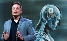 Elon Musk đã &quot;copy&quot; thành công não của chính mình