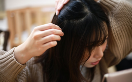 6 loại thực phẩm giúp &quot;nhuộm đen&quot; tóc bạc, nuôi dưỡng tóc