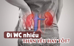 Đi tiểu nhiều sau khi uống nước là thận yếu hay tốt? 7 điều sau đây chính là câu trả lời mà mọi người cần biết