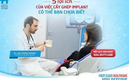 5 lợi ích của việc cấy ghép Implant có thể bạn chưa biết