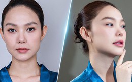 Dự đoán phương pháp làm đẹp lên ngôi: Dịch dưỡng tế bào gốc Exosome Bio