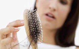 Gợi ý 4 loại dầu gội trị rụng tóc hiệu quả dành cho các chị em