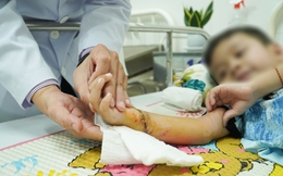 Cấp cứu bé trai 5 tuổi bị đứt lìa bàn tay sau tai nạn giao thông