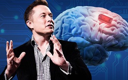 Elon Musk tự tin về công nghệ cấy chip não