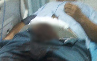 Uống rượu quá nhiều, người đàn ông tự tay cắt “của quý”