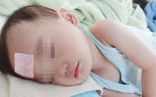 6 trường hợp tử vong vì nhiễm Adenovirus: BS khuyến cáo dấu hiệu nhận biết và việc cần làm để phòng kèo cá cược nhà cái
