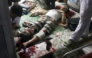 “Rùng rợn“: Giang hồ đâm chém tàn độc, cắt đứt gân chân tỷ lệ kèo nhà cái