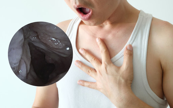 Người đàn ông ho ra máu kèm khó thở: Bác sĩ cảnh báo loại bệnh thường gặp