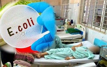 Vụ hơn 500 người ngộ độc sau khi ăn bánh mì tại TP Long Khánh, 3 bệnh nhi bị nhiễm trùng E.Coli: Vi khuẩn này nguy hiểm thế nào?
