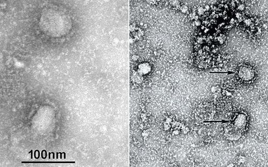Trung Quốc công bố "chân dung" virus corona: Sự nguy hiểm chết người đằng sau tử thần nhỏ hơn cả bụi siêu mịn