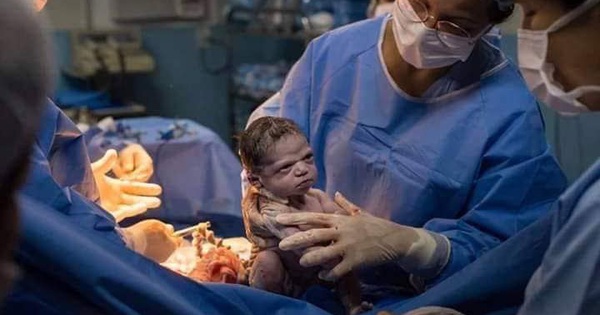 vui vẻ không quạu nha ảnh chế