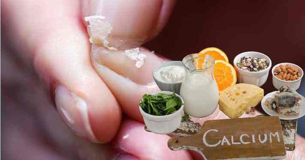 Chuyên gia dinh dưỡng chỉ ra 8 dấu hiệu thiếu canxi dễ nhận thấy nhất